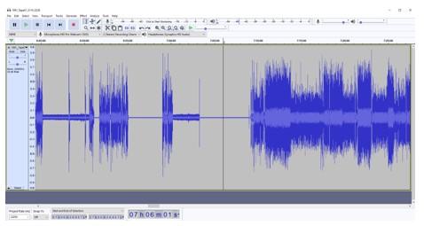 recording after to spectral analysis and filtration